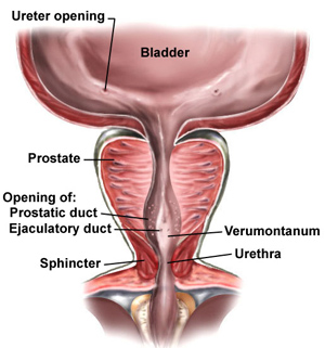transurethral-resection-of-the-prostate-surgery.jpg